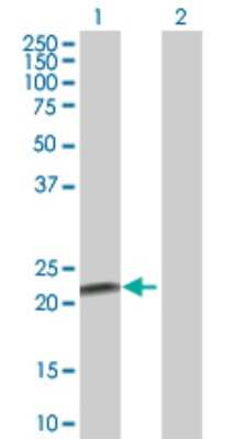 Western Blot: FKBP11 Antibody [H00051303-B01P]