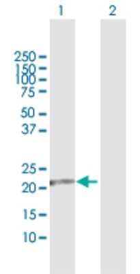 Western Blot: FKBP11 Antibody [H00051303-D01P]