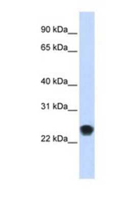 Western Blot: FKBP11 Antibody [NBP1-69386]