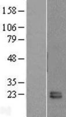 Western Blot: FKBP11 Overexpression Lysate [NBL1-10730]