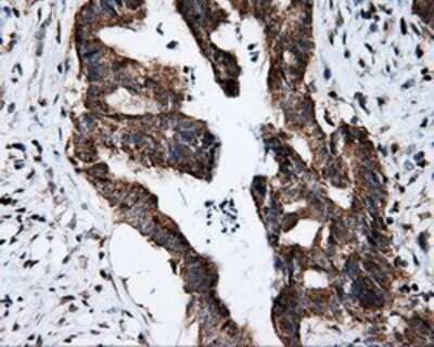 Immunohistochemistry: FKBP12 Antibody (OTI3B3) - Azide and BSA Free [NBP2-70741]