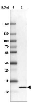 Western Blot: FKBP12 Antibody [NBP2-14017]