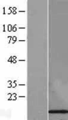 Western Blot: FKBP12 Overexpression Lysate [NBL1-10732]