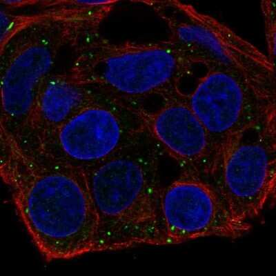 Immunocytochemistry/ Immunofluorescence: FKBP12.6 Antibody [NBP2-68663]