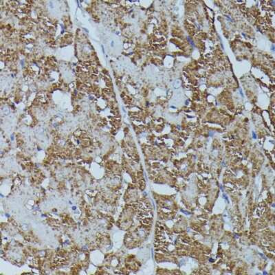 Immunohistochemistry-Paraffin: FKBP12.6 Antibody - Azide and BSA Free [NBP3-02968]