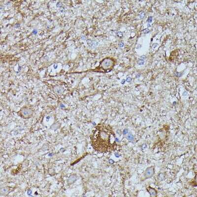Immunohistochemistry-Paraffin: FKBP12.6 Antibody - Azide and BSA Free [NBP3-02968]