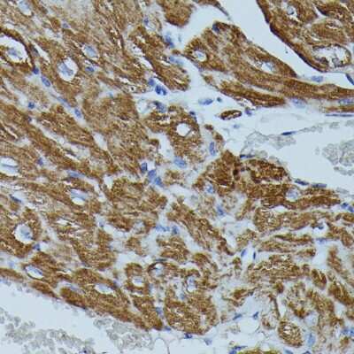 Immunohistochemistry-Paraffin: FKBP12.6 Antibody - Azide and BSA Free [NBP3-02968]