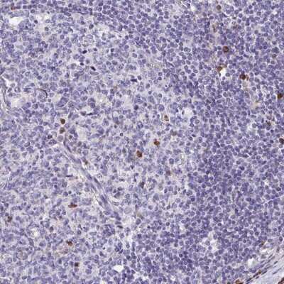Immunohistochemistry-Paraffin: FKBP13/FKBP2 Antibody [NBP2-38604]