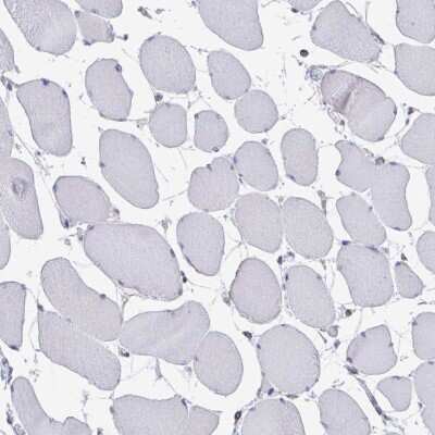 Immunohistochemistry-Paraffin: FKBP13/FKBP2 Antibody [NBP2-38604]