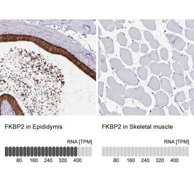 Immunohistochemistry-Paraffin: FKBP13/FKBP2 Antibody [NBP2-38604]