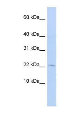 Western Blot: FKBP13/FKBP2 Antibody [NBP1-79721]