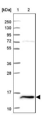 Western Blot: FKBP13/FKBP2 Antibody [NBP2-38604]