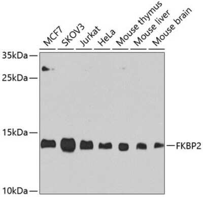 Western Blot: FKBP13/FKBP2 AntibodyBSA Free [NBP3-03582]