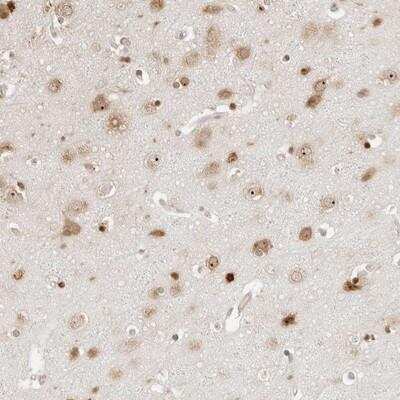 Immunohistochemistry-Paraffin: FKBP14 Antibody [NBP1-83891]