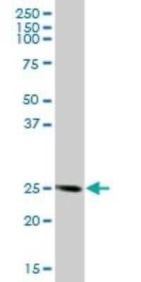 Western Blot: FKBP14 Antibody [H00055033-B01P]