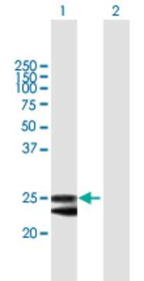 Western Blot: FKBP14 Antibody [H00055033-B01P]