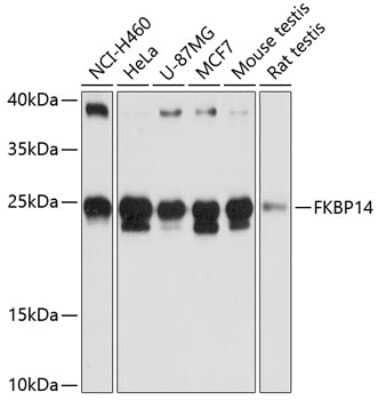 Western Blot: FKBP14 AntibodyAzide and BSA Free [NBP3-04834]