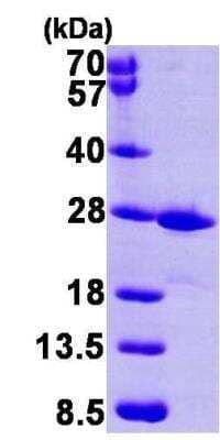 SDS-PAGE: Recombinant Human FKBP14 His Protein [NBP1-45269]