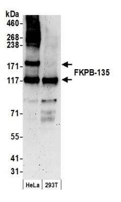 Western Blot: FKBP15 Antibody [NB100-423]