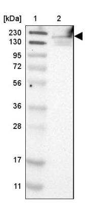 Western Blot: FKBP15 Antibody [NBP1-82972]