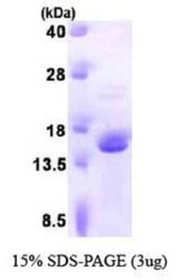 SDS-PAGE: Recombinant Human FKBP13/FKBP2 Protein [NBP1-41233]