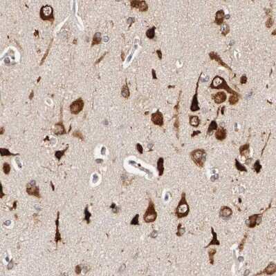 Immunohistochemistry-Paraffin: FKBP25 Antibody [NBP1-87929]