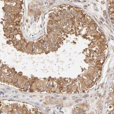 Immunohistochemistry-Paraffin: FKBP25 Antibody [NBP1-87929]