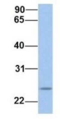Western Blot: FKBP25 Antibody [NBP1-54354]