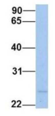 Western Blot: FKBP25 Antibody [NBP1-54354]