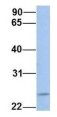 Western Blot: FKBP25 Antibody [NBP1-54354]
