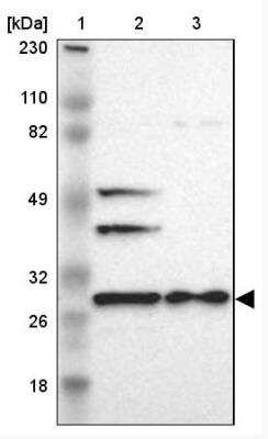 Western Blot: FKBP25 Antibody [NBP1-87929]