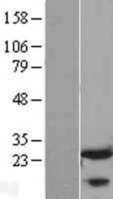 Western Blot: FKBP25 Overexpression Lysate [NBL1-10737]