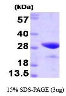 SDS-PAGE: Recombinant Human FKBP25 Protein [NBP1-41160]