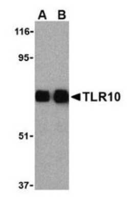 Western Blot: FKBP38 Antibody [NB110-85535]