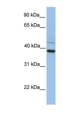 Western Blot: FKBP38 Antibody [NBP1-59019]