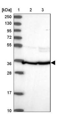 Western Blot: FKBP38 Antibody [NBP2-33440]