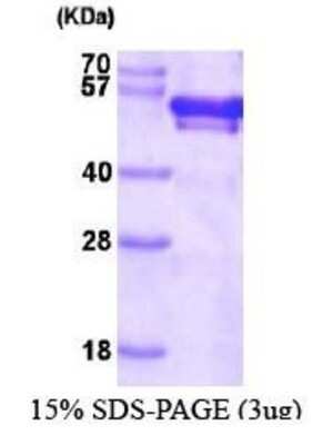 SDS-PAGE: Recombinant Human FKBP52/FKBP4 His Protein [NBC1-22936]