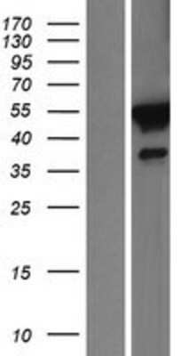 Western Blot: FKBP51/FKBP5 Overexpression Lysate [NBL1-10739]