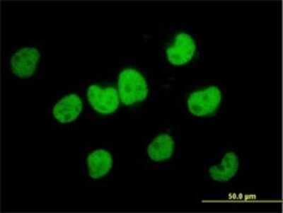 Immunocytochemistry/ Immunofluorescence: FKBP51/FKBP5 Antibody (3D1-1B10) [H00002289-M02]