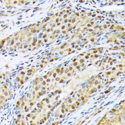 Immunohistochemistry-Paraffin: FKBP51/FKBP5 Antibody (7W2R1) [NBP3-16750]