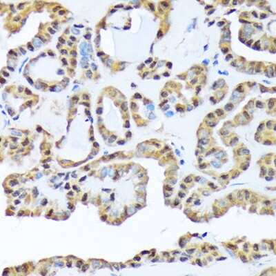 Immunohistochemistry-Paraffin: FKBP51/FKBP5 Antibody (7W2R1) [NBP3-16750]