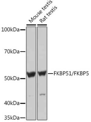 Western Blot: FKBP51/FKBP5 Antibody (7W2R1) [NBP3-16750]