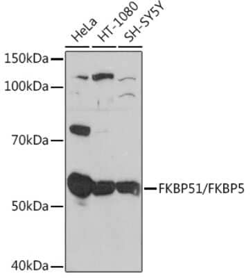 Western Blot: FKBP51/FKBP5 Antibody (7W2R1) [NBP3-16750]