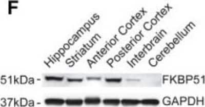 Western Blot: FKBP51/FKBP5 Antibody (Hi51B) [NB110-96873]