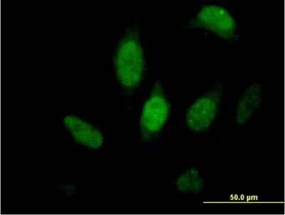 Immunocytochemistry/ Immunofluorescence: FKBP51/FKBP5 Antibody [H00002289-B01P]