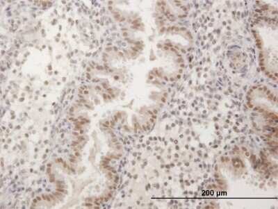 Immunohistochemistry-Paraffin: FKBP51/FKBP5 Antibody [H00002289-B01P]