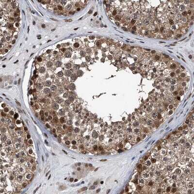 Immunohistochemistry-Paraffin: FKBP51/FKBP5 Antibody [NBP1-84676]