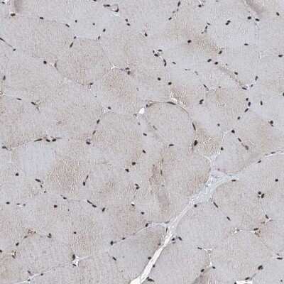 Immunohistochemistry-Paraffin: FKBP51/FKBP5 Antibody [NBP1-84676]