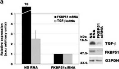 Knockdown Validated: FKBP51/FKBP5 Antibody [NB100-68240]