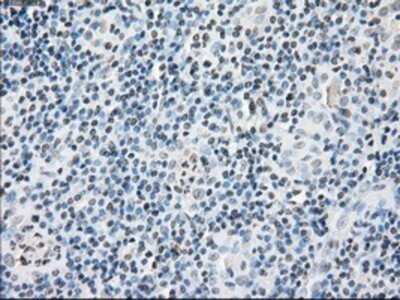 Immunohistochemistry: FKBP51/FKBP5 Antibody (OTI3E9) - Azide and BSA Free [NBP2-70742]